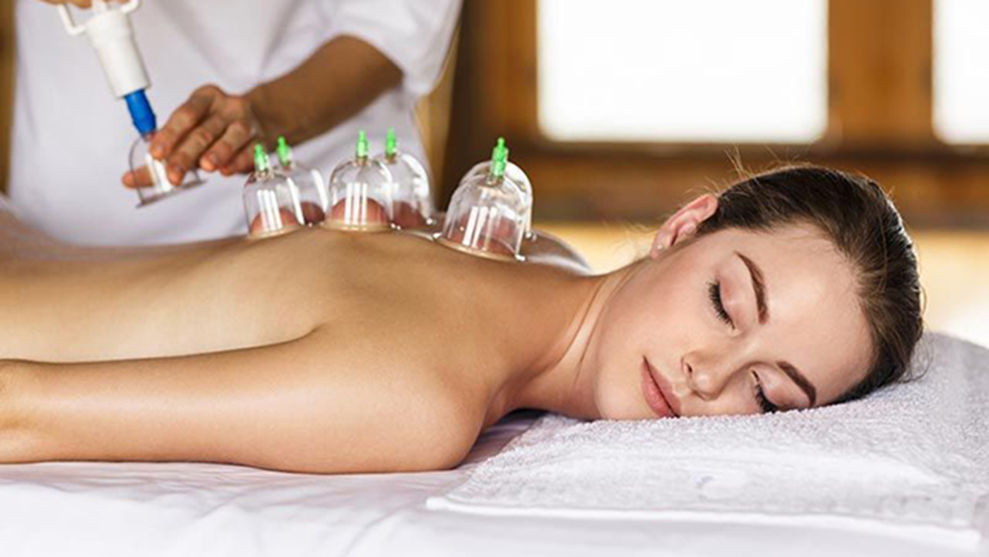 cupping therapy melbourne